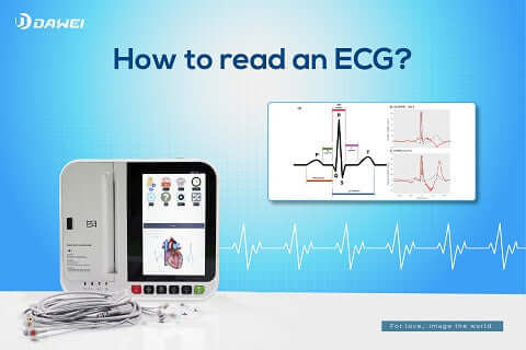 How to read an ECG? EKG/Electrocardiogram