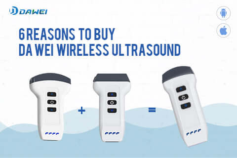 6 Reasons to Buy Dawei Wireless Ultrasound
