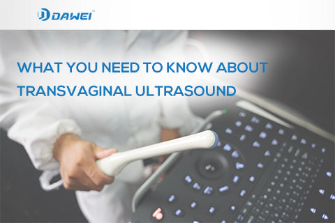 What you need to know about transvaginal ultrasound
