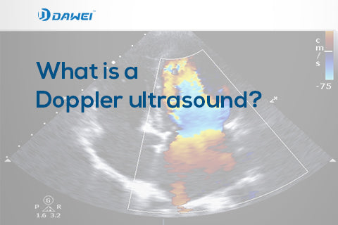What is a Doppler ultrasound?