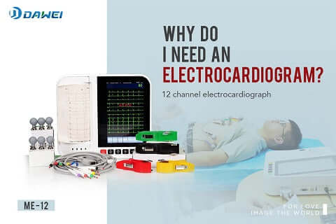 Why do I need an electrocardiogram? Who needs it?