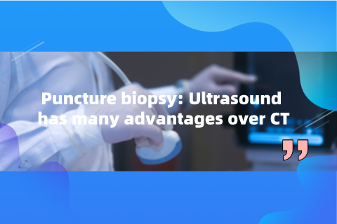 Puncture biopsy: Ultrasound has many advantages over CT