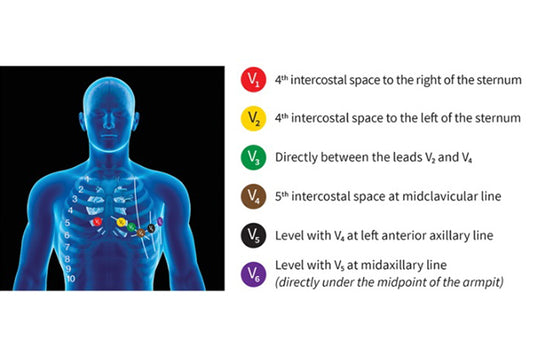 Simple Steps for 12-lead ECG Application