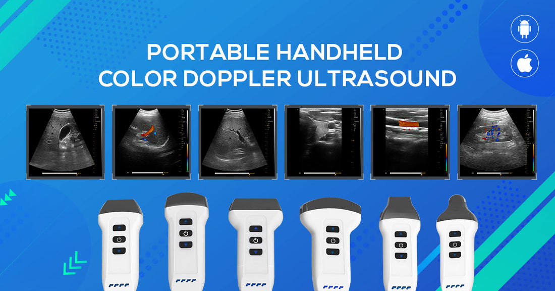 Wireless Handheld Ultrasound: Differences, Advantages, Buying Guide, and Top 10 Industry Manufacturers or brand