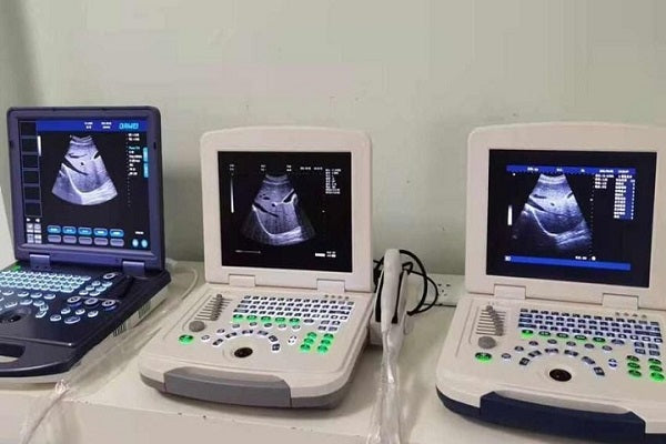 What Makes Portable Ultrasounds So Popular?