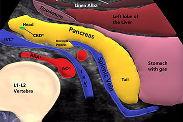 We are thankful for clearly visualized pancreas