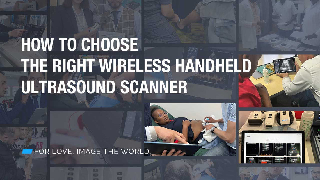 How To Choose the Right Wireless Handheld Ultrasound Scanner?