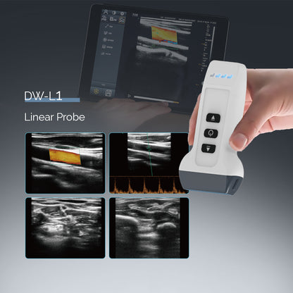 Wireless Phone Ultrasound Probe Color Doppler Ultrasound Machine Linear Convex 128 Elements Support IOS Android | DAWEI