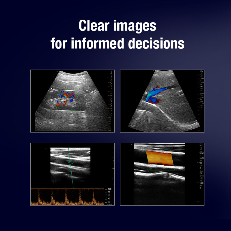 Flexible Wireless Handheld Ultrasound with Dual Curved and Linear Transducers for Crystal-Clear Imaging