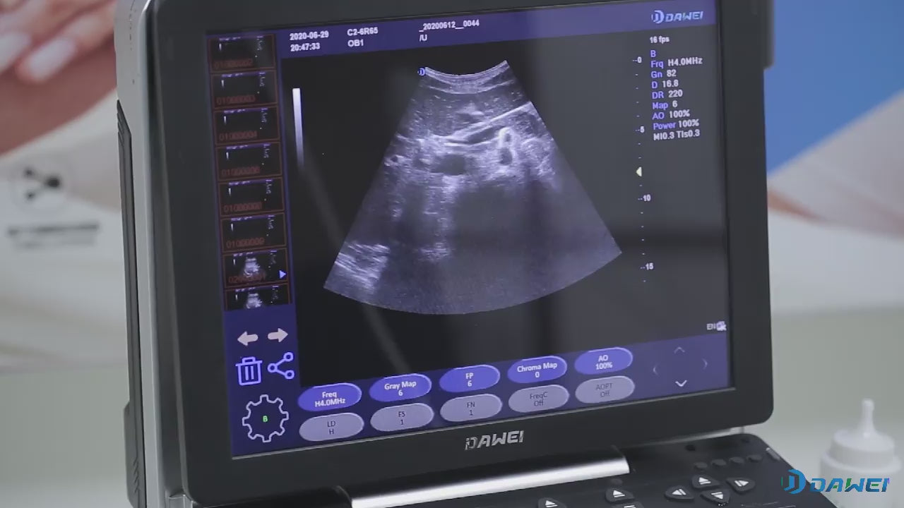Carregar vídeo: Hospital Clinic Health Care Center Portable 4D OB&amp;GYN Color Doppler Ultrasound Machine K6 | DAWEI