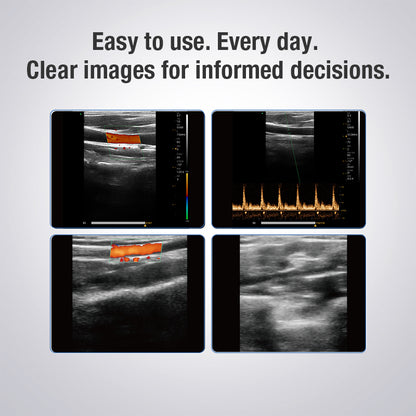 DAWEI Color Doppler Wireless Ultrasound Dual-head Linear Convex Probe for Whole-body Scanning