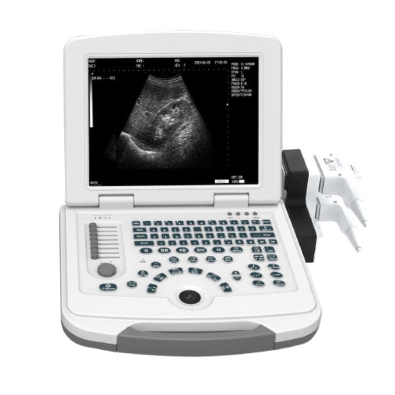 B&W ultrasound machine